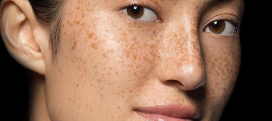 skin damage: everything you need to know - Dermalogica Malaysia
