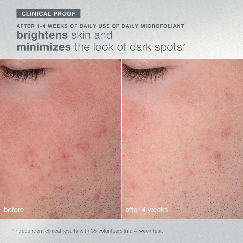 petite pleasures (daily microfoliant 13g)