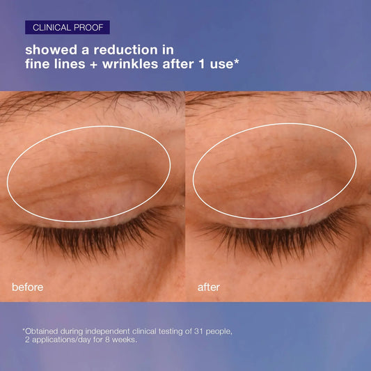 phyto nature lifting eye cream
