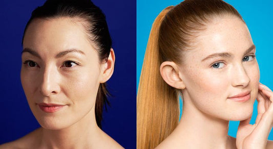 the difference between adult acne and teen acne - Dermalogica Malaysia