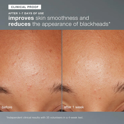 daily microfoliant exfoliator