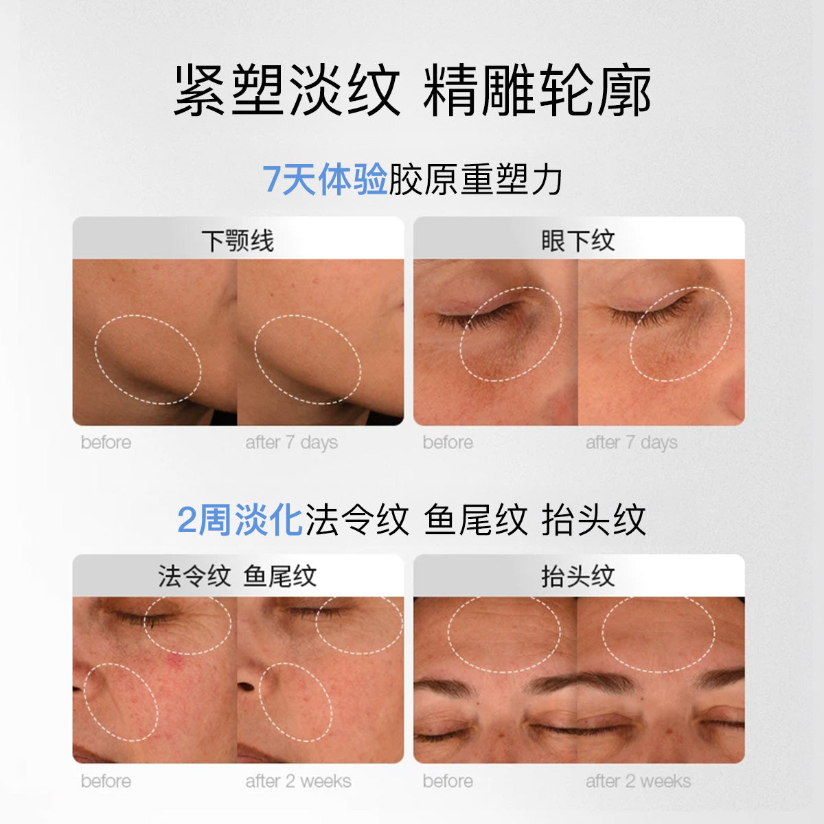serum perbankan pro-kolagen
