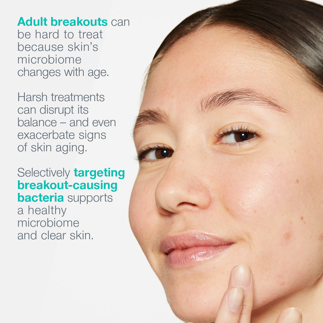 breakout biotic moisturizer