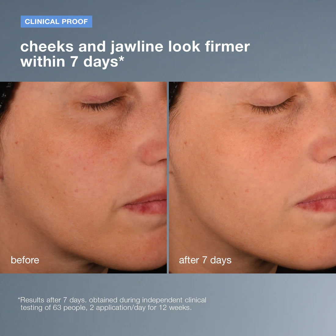 pro-collagen banking serum