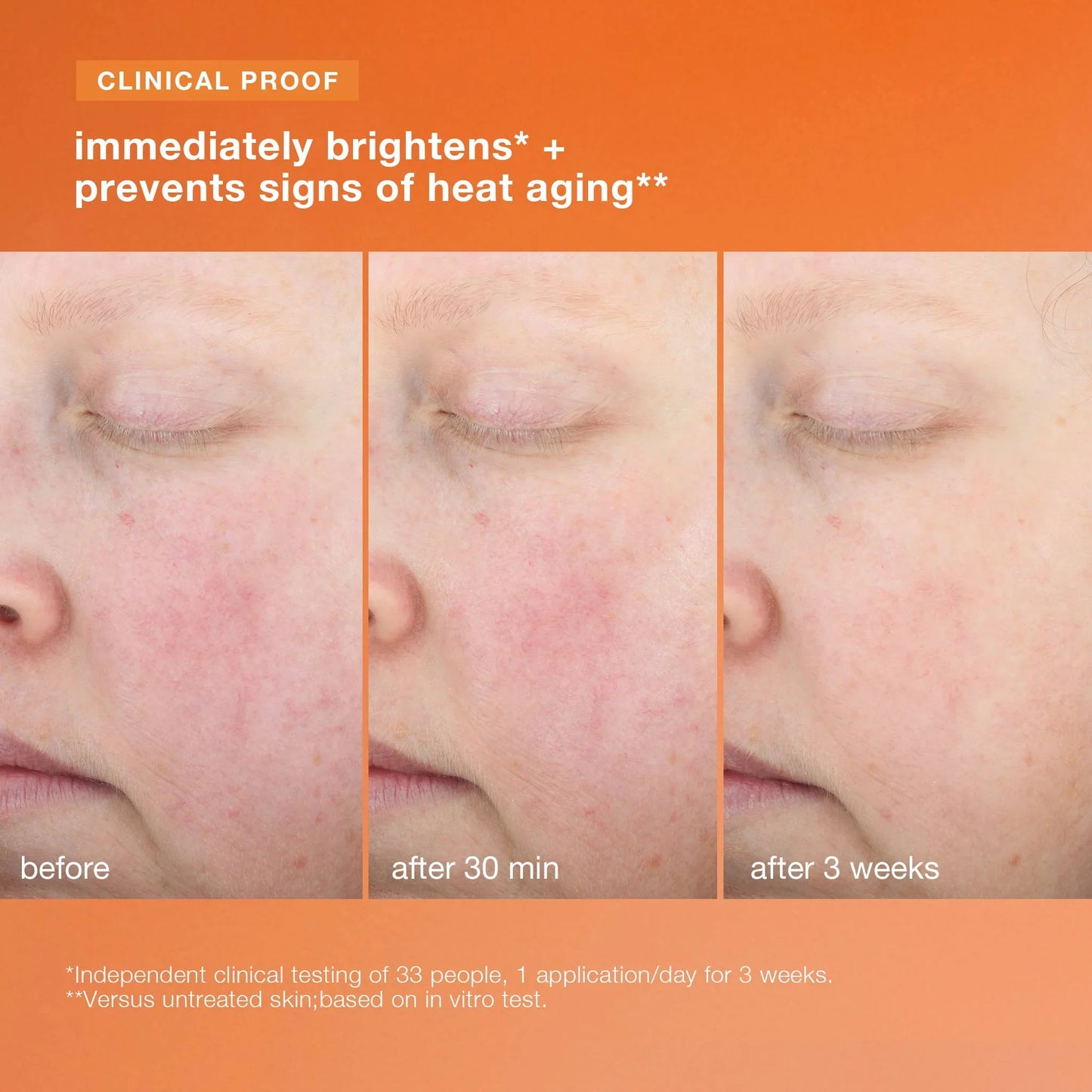 biolumin-c heat aging protector spf50 5ml (worth RM60)