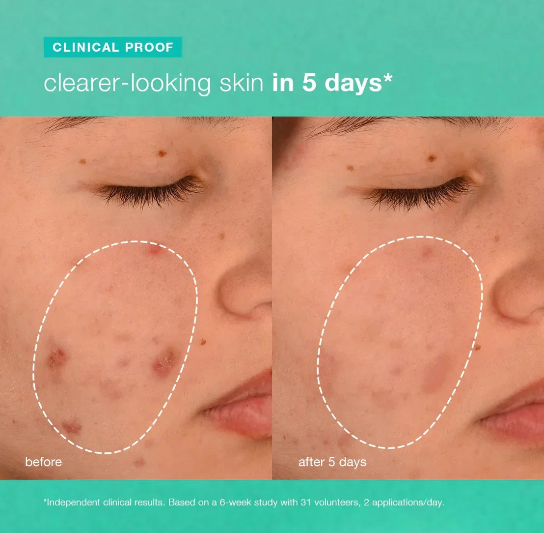 pelembap biotik breakout