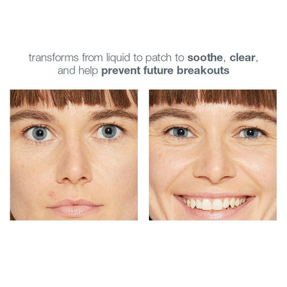 deep breakout invisible liquid patch - Dermalogica Malaysia
