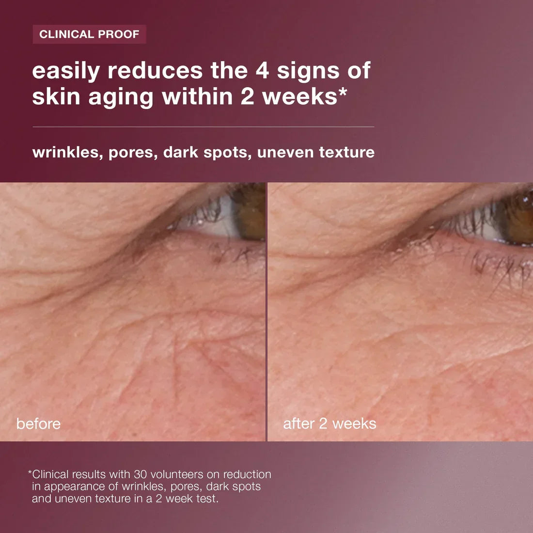 serum retinol kulit dinamik