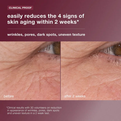 serum retinol kulit dinamik