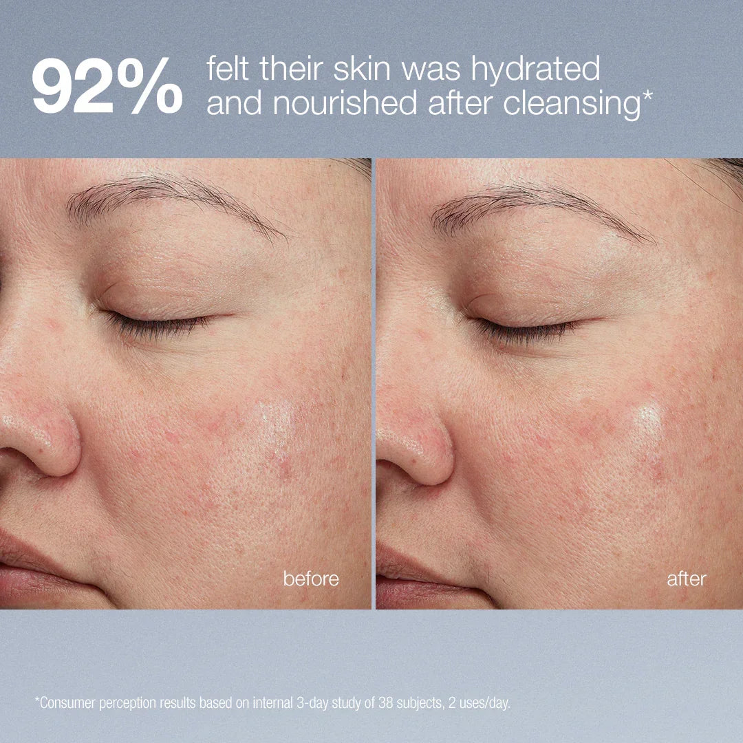 pembersih cahaya selepas magnetik[+]