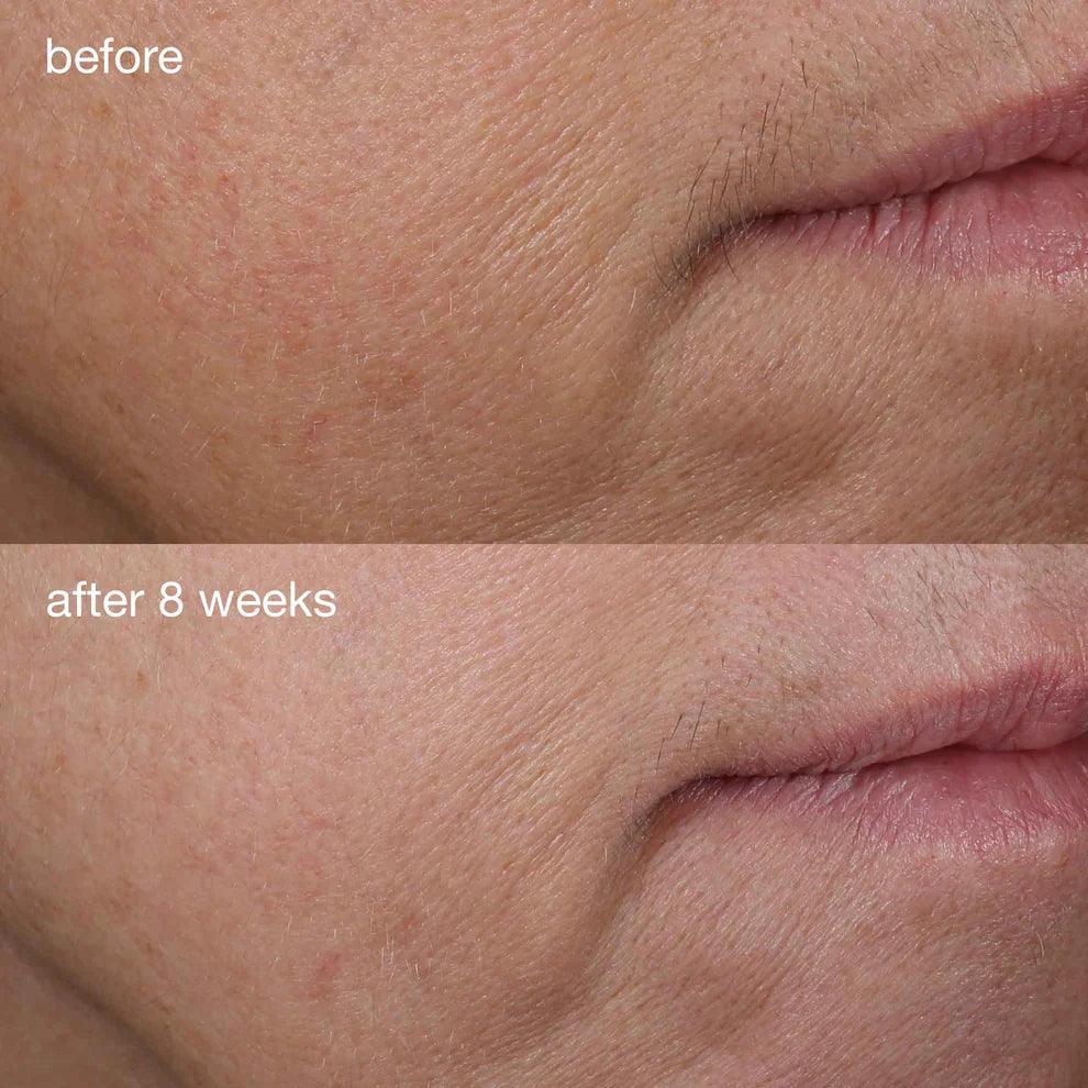 serum pengencang phyto-nature