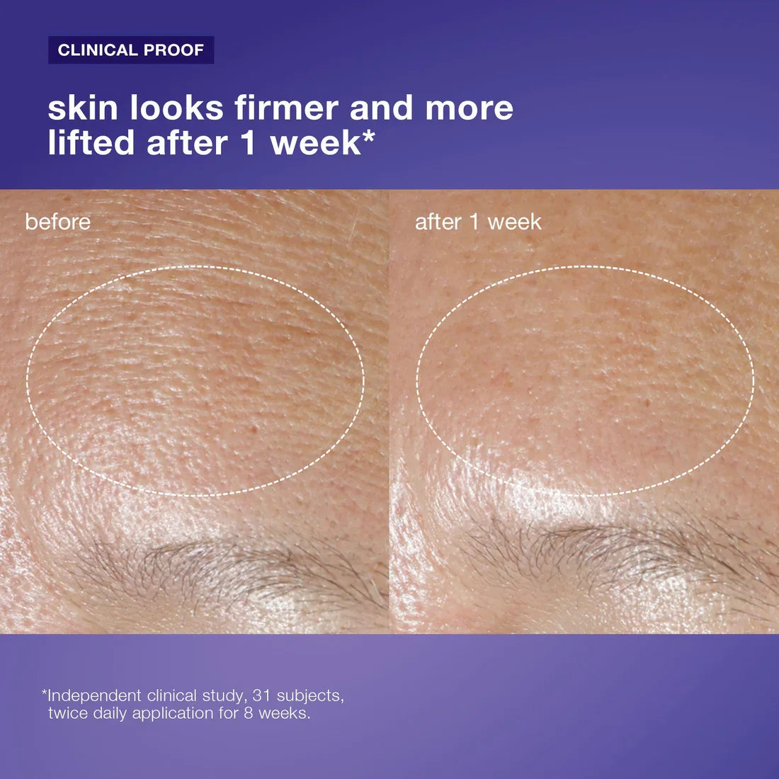 krim oksigen phyto nature