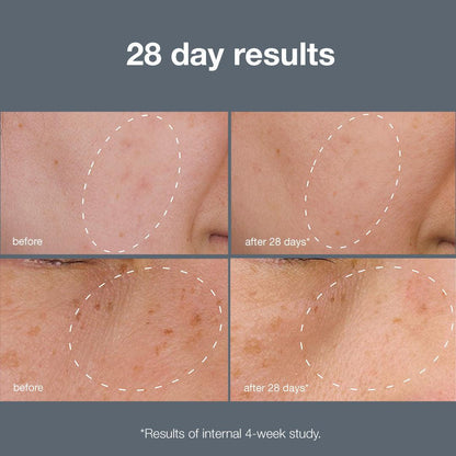 powerbright dark spot system - Dermalogica Malaysia
