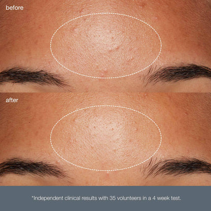 reawakening skin intro kit - Dermalogica Malaysia
