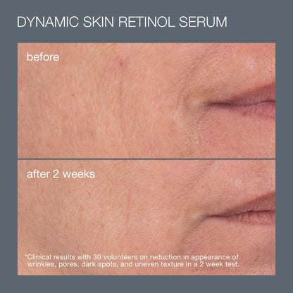 skin aging solutions set (2 full-size best sellers) worth RM629 - Dermalogica Malaysia