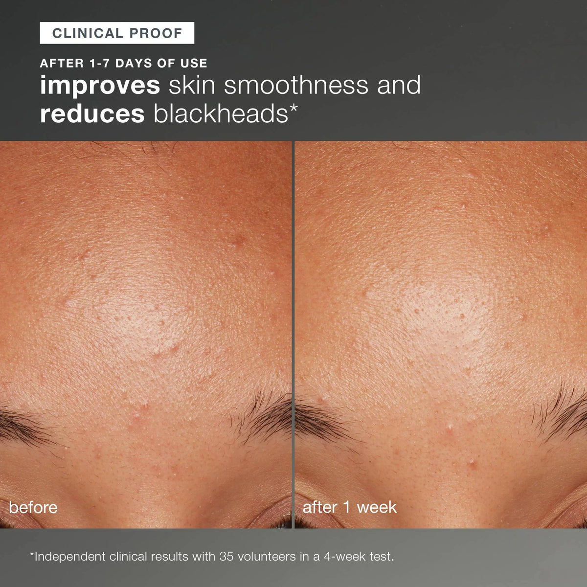 ultra clean, ultra smooth duo (2 full-size) (worth RM648) – Dermalogica ...