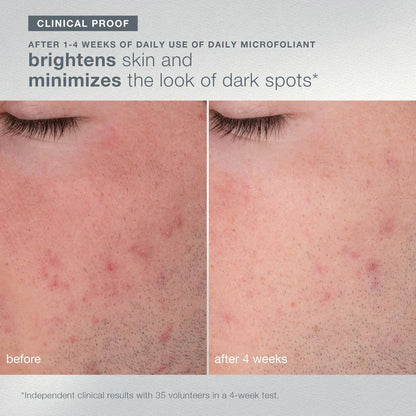 warmth of the winter sun set (3 travel-size)